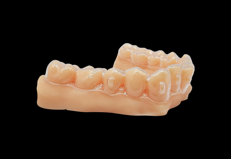 什么是3d打印正畸牙模？3d打印正畸牙模怎么做？